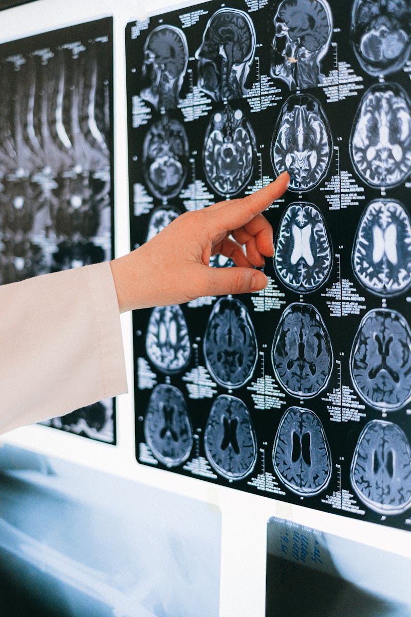 neurologist doctor consultation brain nervous system examination